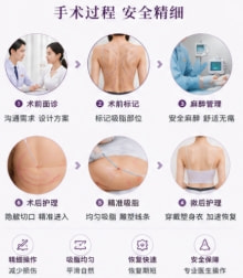 背部吸脂(富贵包 / 副乳)