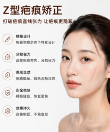 Z型疤痕矫正.png