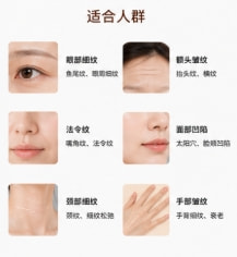 注射自体脂肪去皱