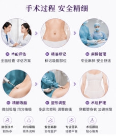 全身吸脂