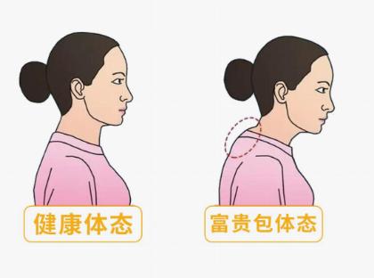 富贵包