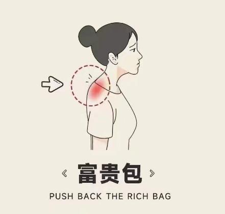 微创去除富贵包