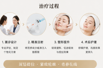 筋膜提升