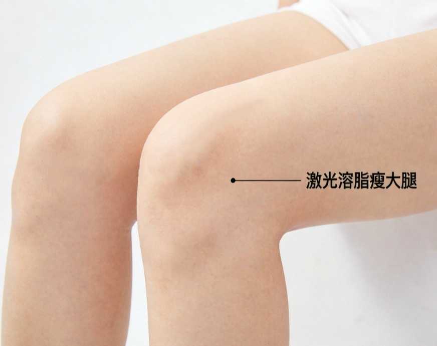大腿环吸