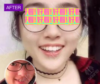 太全面!您有一份遵义韩美整形价格和隆胸吸脂祛斑等案例效果图,请查收。