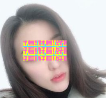 必须得说我被遵义韩美做的这个瘦脸+假体垫下巴后的我迷住了。 图2