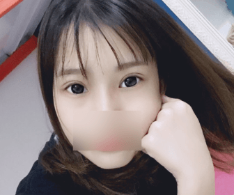 汕头曙光割双眼皮多少钱?我找殷运成医生做的眼综合花了一万多元效果还不错 图2