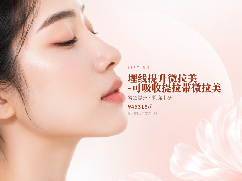 埋线提升微拉美-可吸收提拉带微拉美