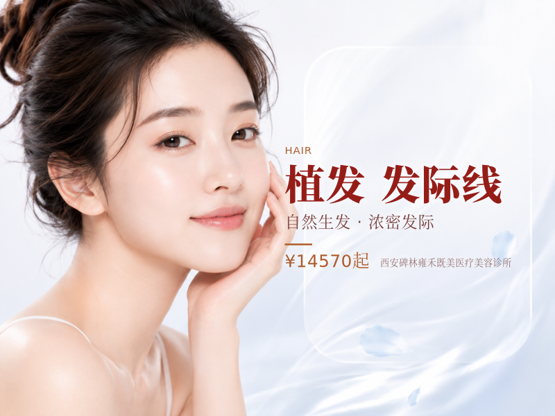 【女性植发爆款】1-2000毛囊单位发际线种植