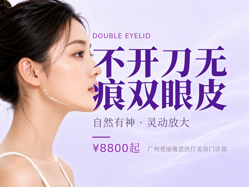 不开刀无痕双眼皮