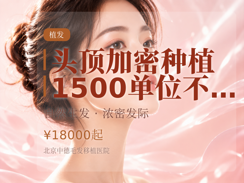 头顶加密种植 | 1500 单位【不剃发】