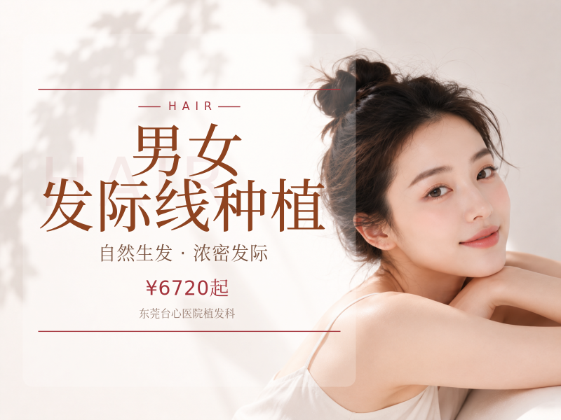 男女发际线种植