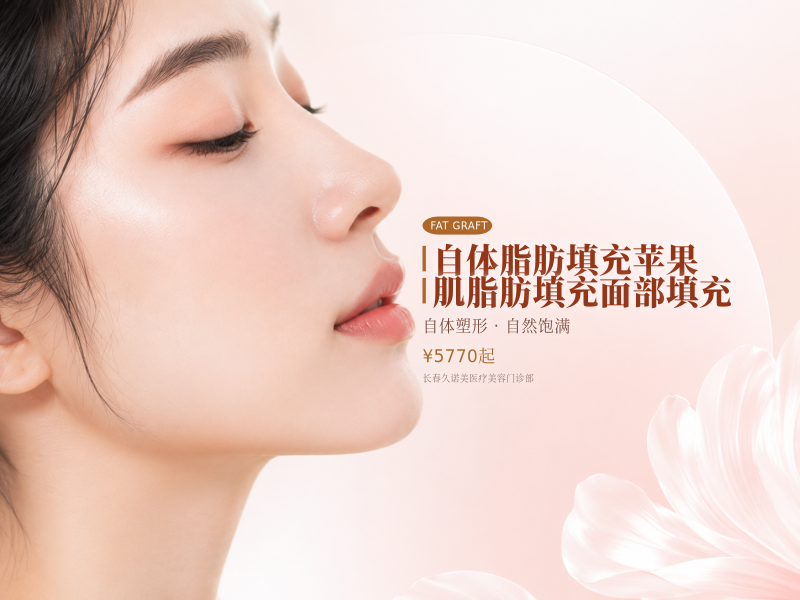 自体脂肪填充苹果肌脂肪填充面部填充