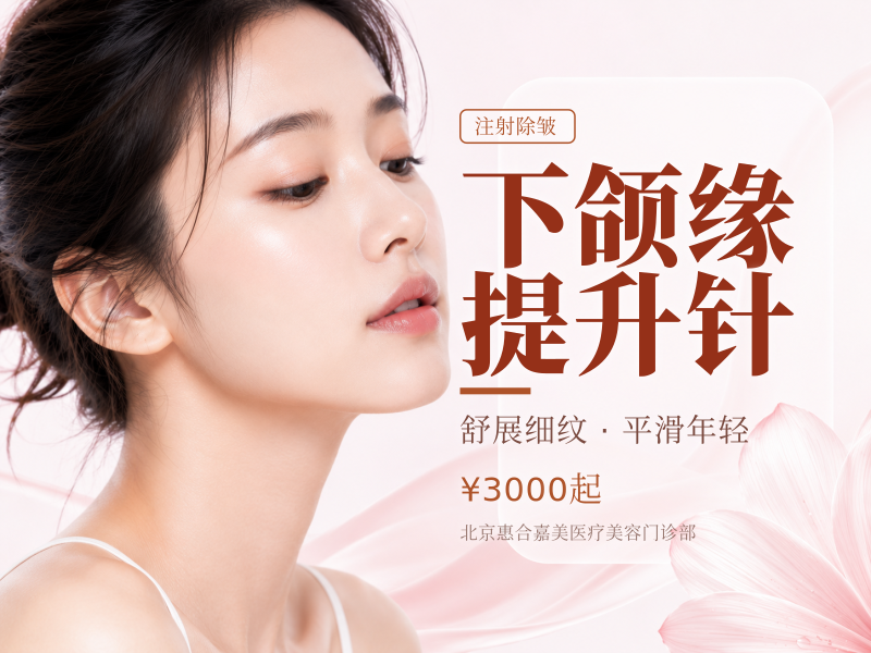 下颌缘提升针