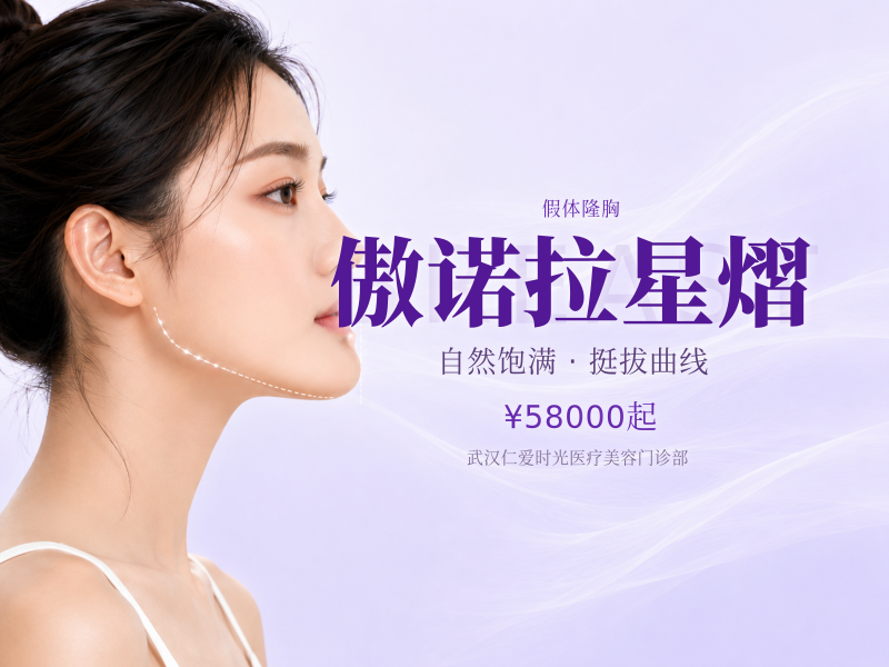 傲诺拉星熠