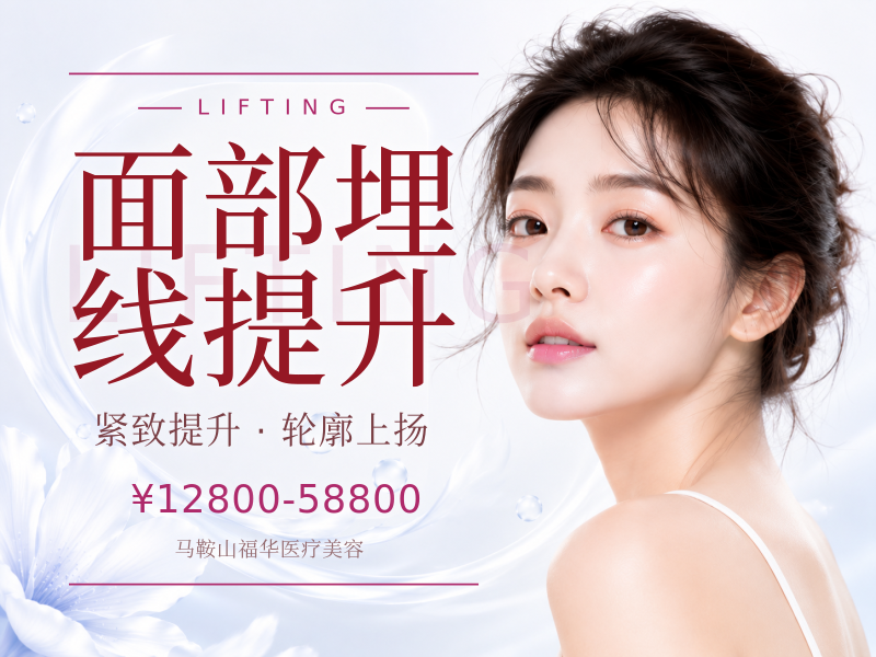 面部埋线提升
