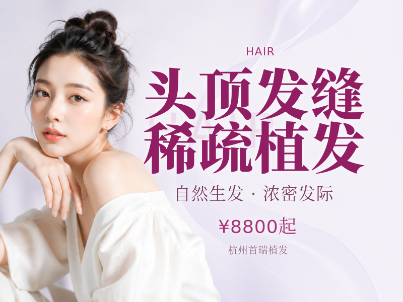 头顶发缝稀疏植发