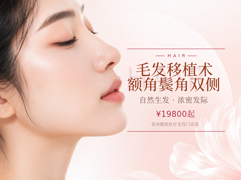 毛发移植术 额角/鬓角双侧