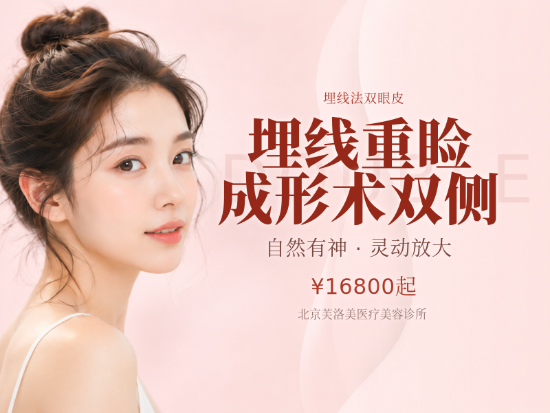 埋线重睑成形术双侧
