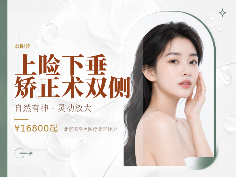 上睑下垂矫正术双侧