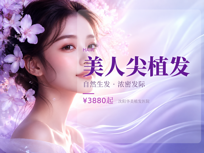 美人尖植发