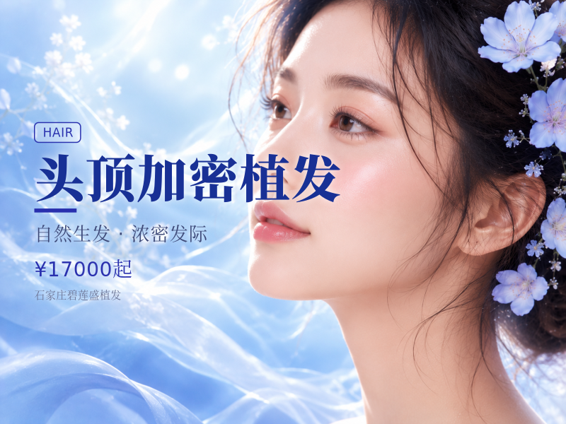 头顶加密植发