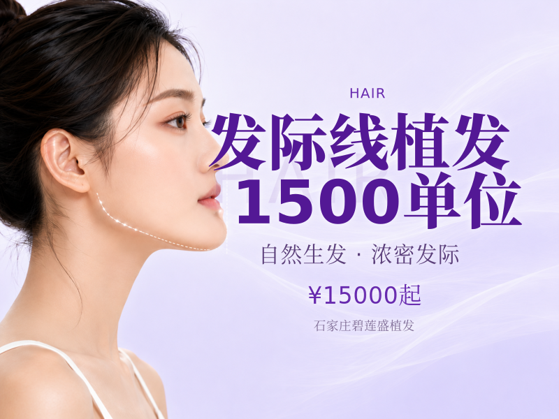 发际线植发1500单位