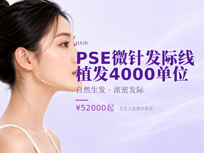 PSE微针发际线植发（剃发）4000单位