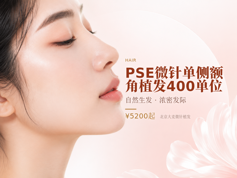PSE微针单侧额角植发400单位