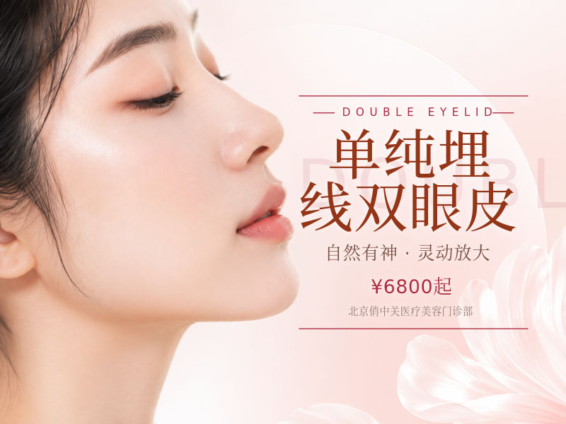 单纯埋线双眼皮
