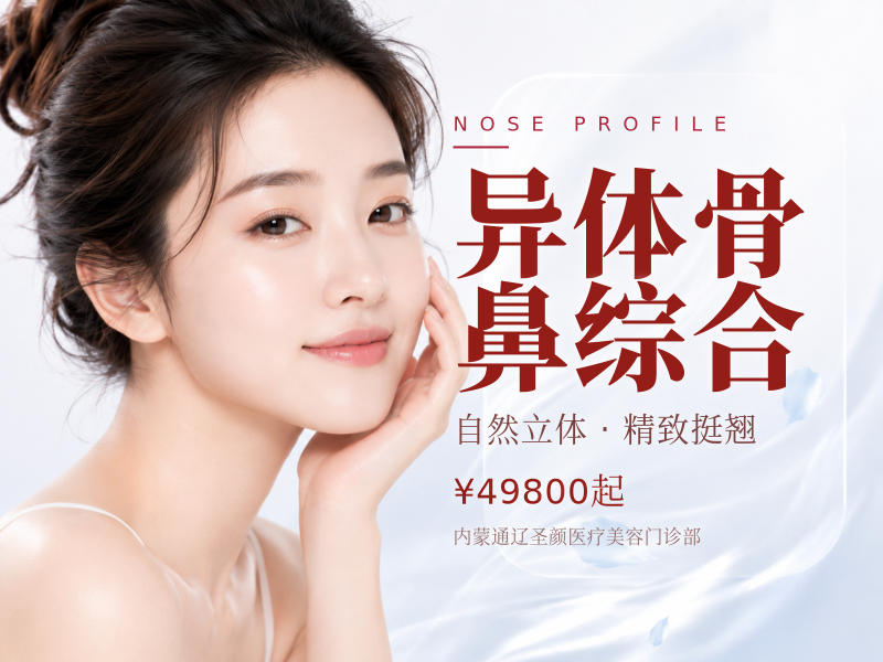 异体骨鼻综合