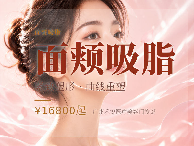 面颊吸脂