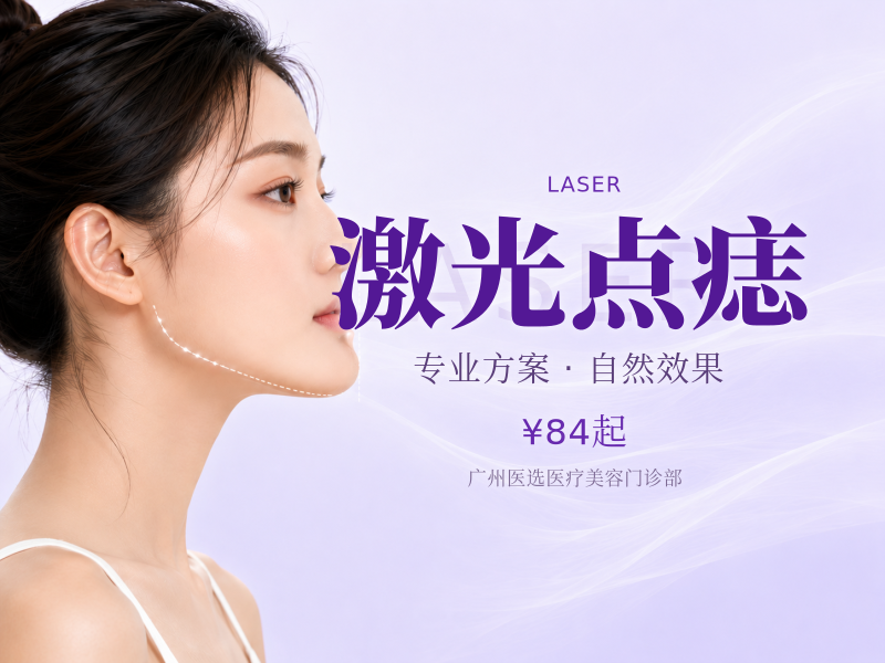 激光点痣