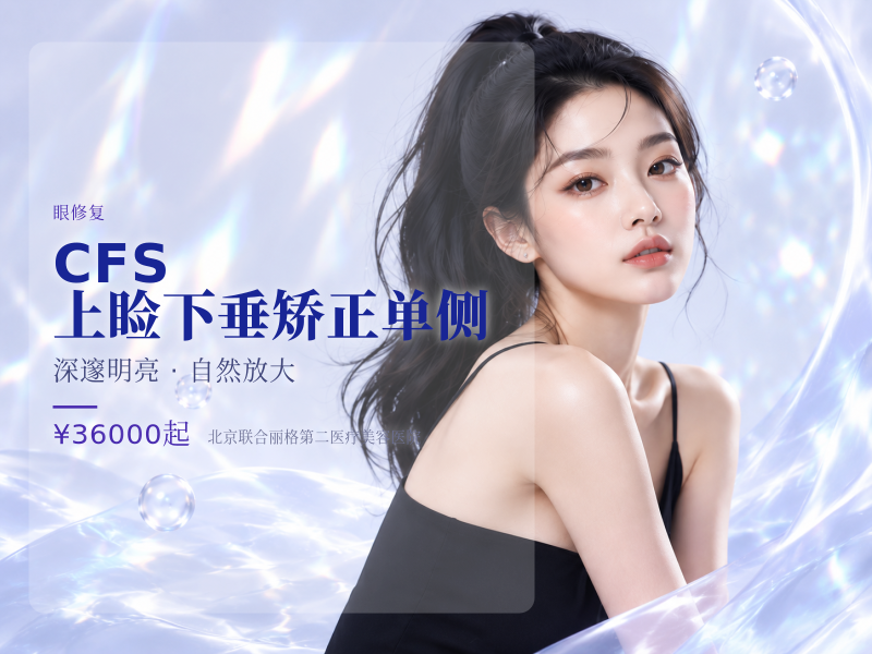 CFS 上睑下垂矫正单侧