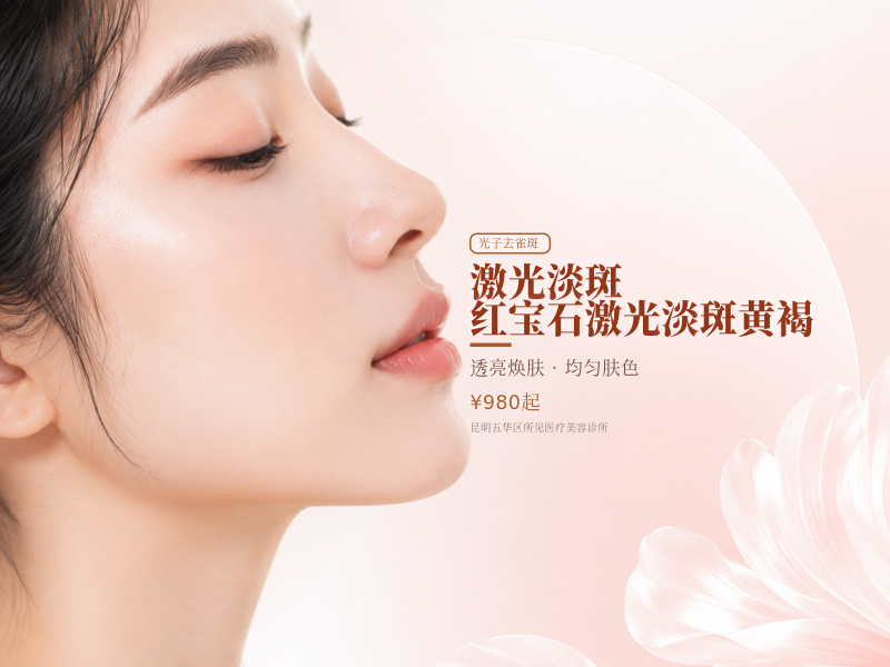激光淡斑｜红宝石激光淡斑｜黄褐