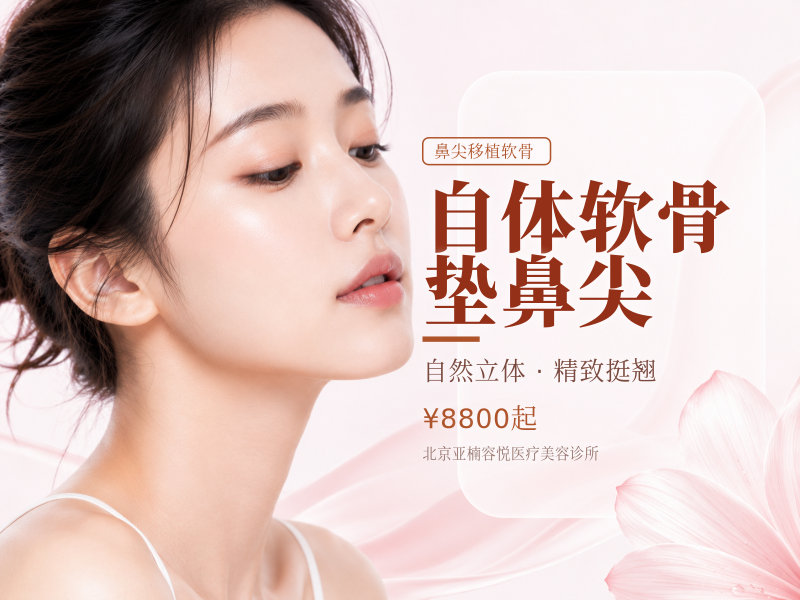 自体软骨垫鼻尖