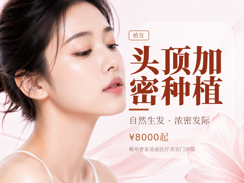 头顶加密种植