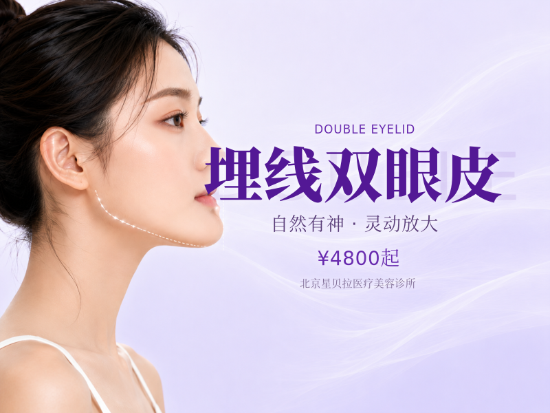 埋线双眼皮