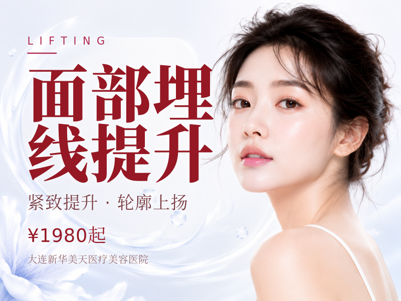 面部埋线提升