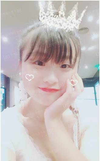 岳阳你美整形医院双眼皮真人案例