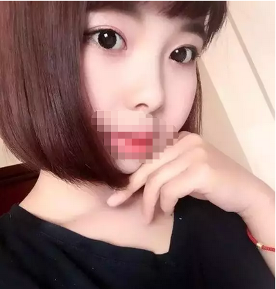 6张照片揭秘我在南充五星做全切双眼皮从术前到恢复的全过程 图2