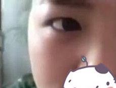 2980元我在驻马店缔莱美做的无痕双眼让我秒变电眼