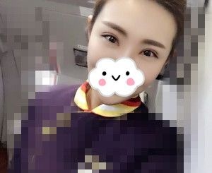 佳木斯韩艺来医疗美容医院谷永安医生让我重新拥有了美丽的眼睛 图2