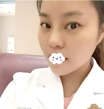 快看啊闺蜜小雪找江门华美整形美容医院欧国升院长做的隆鼻案例美翻了 案例图2
