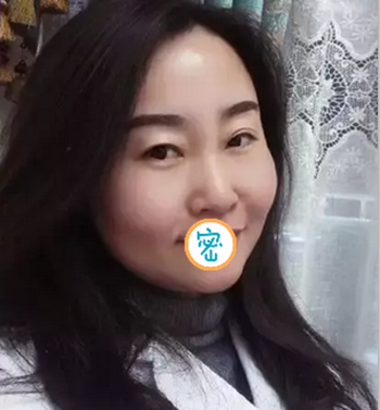 在广安悦美做了治疗 术后即刻就发现面部提升效果明显 图2