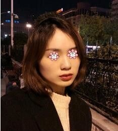 在遵义韩美整形董琪那儿做完下颌角整形+颧骨内推打心眼儿里高兴!