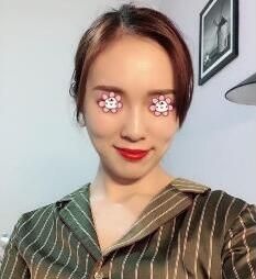 在遵义韩美整形董琪那儿做完下颌角整形+颧骨内推打心眼儿里高兴! 图2