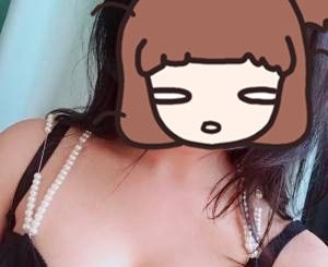 娄底德美陈贵南医生给我做的自体脂肪丰胸,顺便也为我瘦了身,真是两全其美 ,一次到位啊 图2