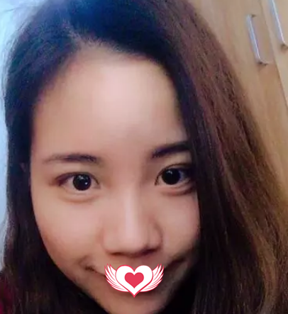 都说季泽东院长做鼻综合效果自然 当我到沧州静港亲身经历了硅胶隆鼻+耳软骨垫鼻尖后觉得果然名不虚传