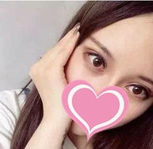 上饶尚美整形张维华做给我做全切双眼皮后,可算是把我之前埋线做坏的双眼皮拯救了 图2